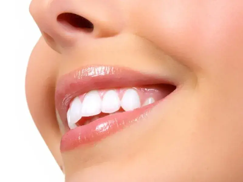 Bleaching Schöne Weiße Zähne